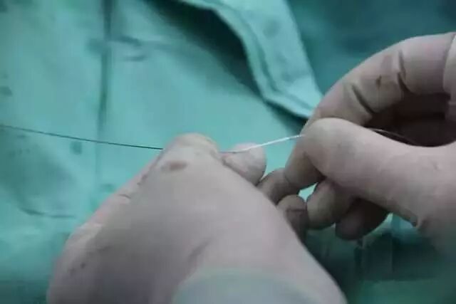 造影导丝是什么请看：这是心脏支架真实的样子_https://www.jmylbn.com_新闻资讯_第15张