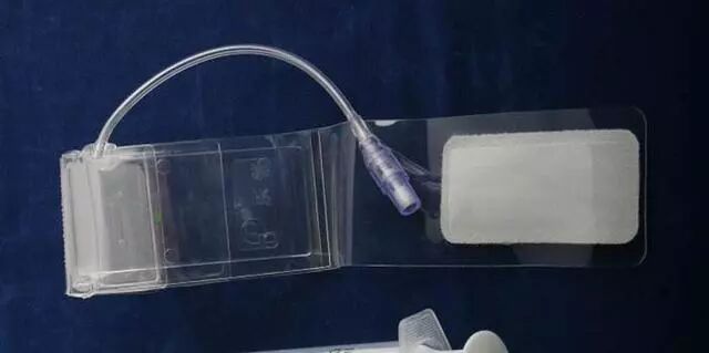 造影导丝是什么请看：这是心脏支架真实的样子_https://www.jmylbn.com_新闻资讯_第25张