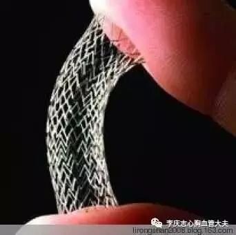 造影导丝是什么请看：这是心脏支架真实的样子_https://www.jmylbn.com_新闻资讯_第2张