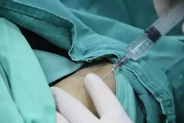 造影导丝是什么请看：这是心脏支架真实的样子_https://www.jmylbn.com_新闻资讯_第6张