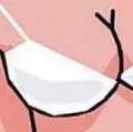 男性乳腺发育是真的吗？