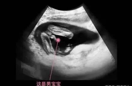 4个的原因男翻女_男翻女可能性_为什么说男翻女几率大