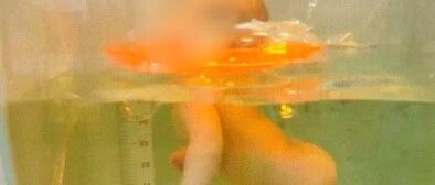 痛心！婴儿在家人监护下游泳窒息身亡，专家提醒：这三大问题要注意