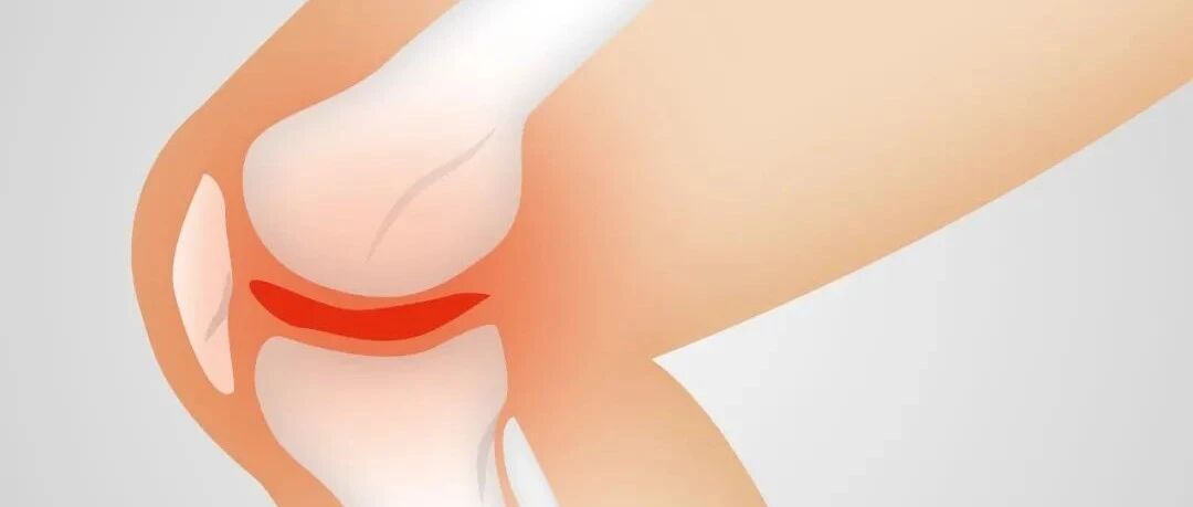 保护全身关节的好方法，赶紧学起来！