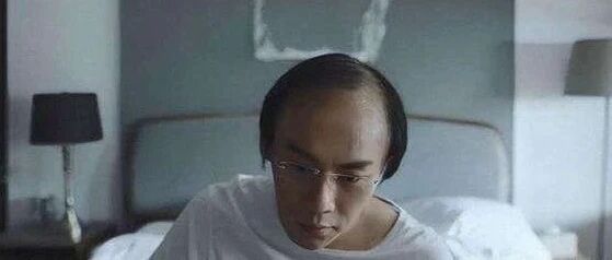 头发少，更要注重日常养护