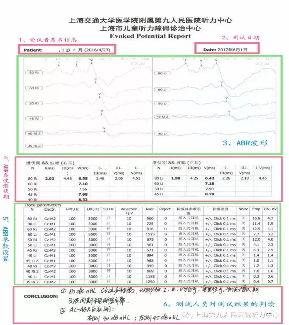 听性脑干反应检查是什么【上海九院专家帮听障宝妈支招（14）】教宝妈读懂听力检查报告单：听性脑干反应ABR报告_https://www.jmylbn.com_新闻资讯_第6张