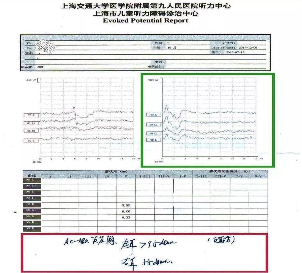听性脑干反应检查是什么【上海九院专家帮听障宝妈支招（14）】教宝妈读懂听力检查报告单：听性脑干反应ABR报告_https://www.jmylbn.com_新闻资讯_第20张