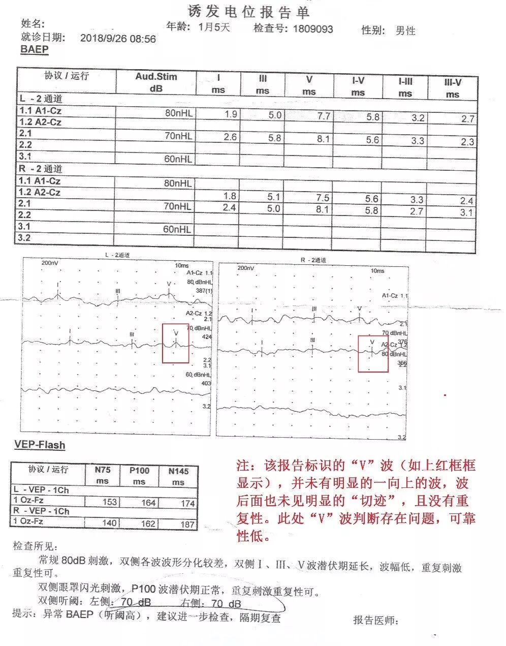 听性脑干反应检查是什么【上海九院专家帮听障宝妈支招（14）】教宝妈读懂听力检查报告单：听性脑干反应ABR报告_https://www.jmylbn.com_新闻资讯_第17张