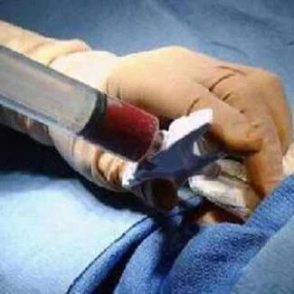 骨髓移植过后易排异，自我管理做好3步，避免感染、稳固病情！