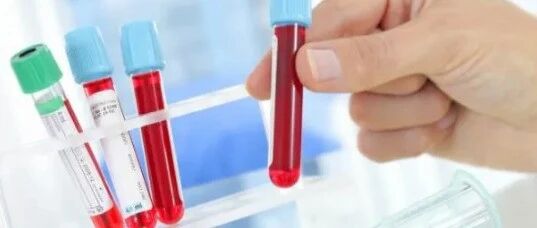 去医院动不动就要查血常规，是必须要做，还是“套路”消费？