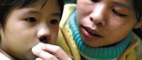 为何会患上白血病？4种“痕迹”出现提示已来临！