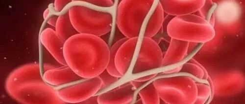 骨髓增生异常综合征这样调理才可以，MDS患者速看！