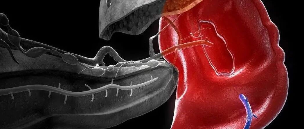 骨髓增生性疾病脾脏肿大，怎么有效“缩脾”？