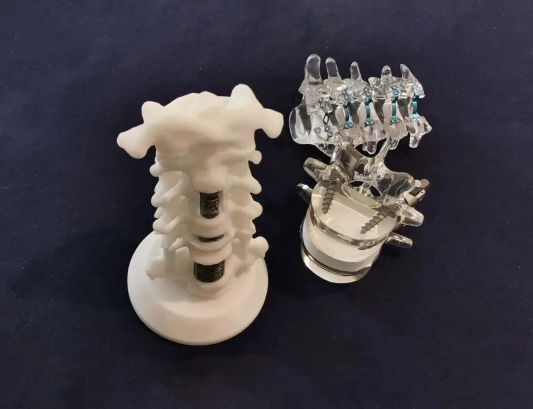 强生脊柱有哪些耗材27000降至1100！美敦力、强生、威高…_https://www.jmylbn.com_新闻资讯_第9张