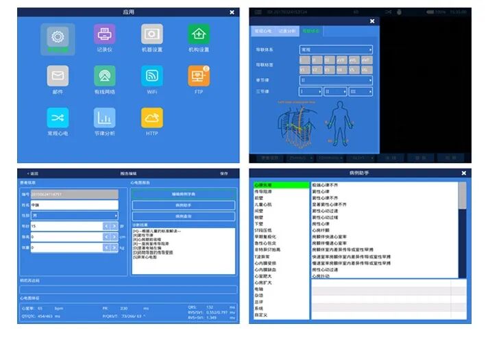 中旗心电图怎么使用聊聊医院刚需设备——心电图机_https://www.jmylbn.com_新闻资讯_第4张