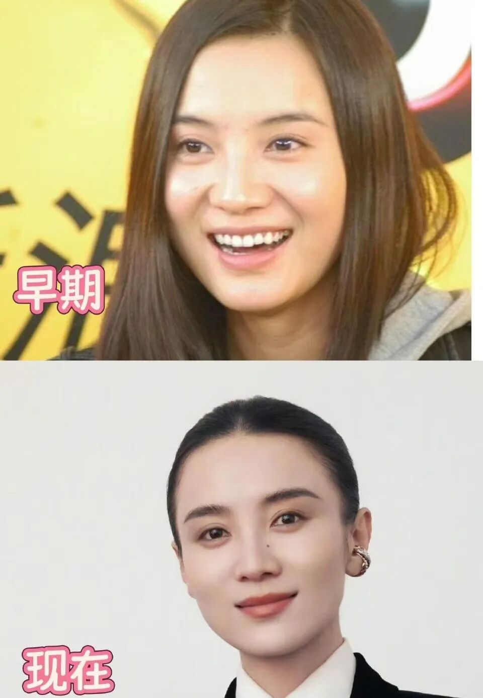 宋佳20岁到40岁的面相变化