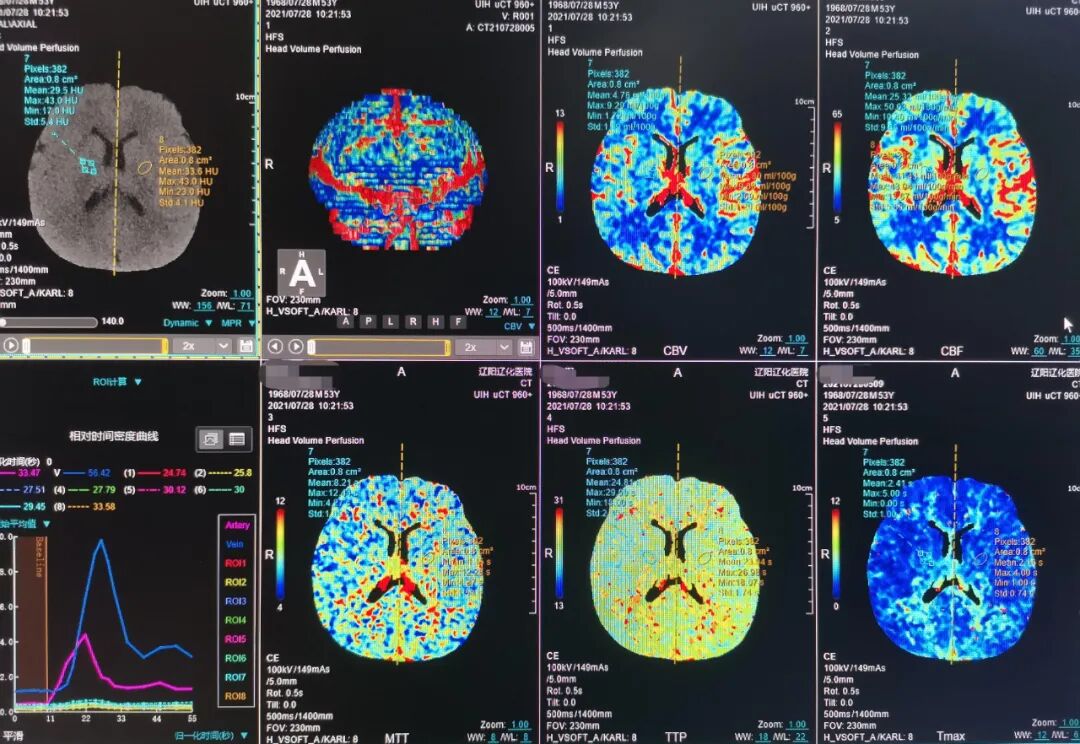 联影ct怎么样CT界的“神兵利器”--联影320排640层CT_https://www.jmylbn.com_新闻资讯_第10张