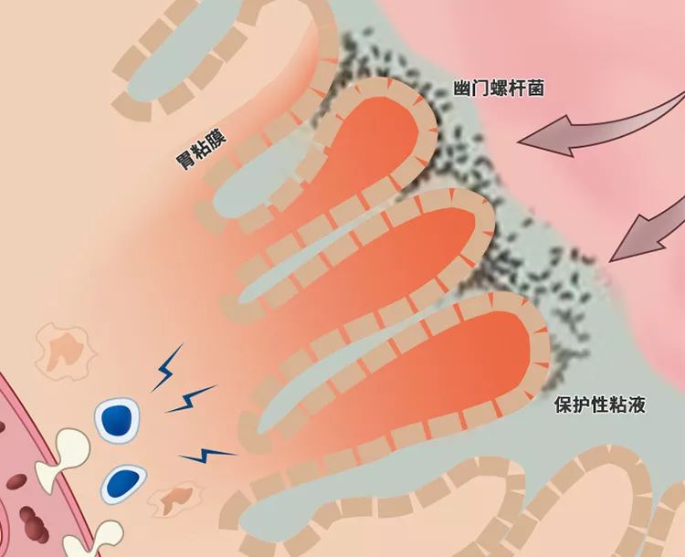 胃痛胃脹胃不適，每天一勺它，告別老胃病 健康 第5張