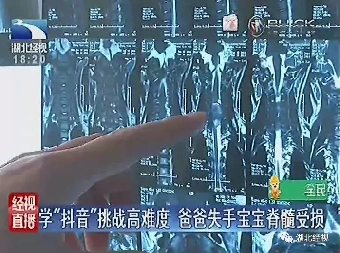 2岁宝宝模仿爸爸看电视姿势一模一样