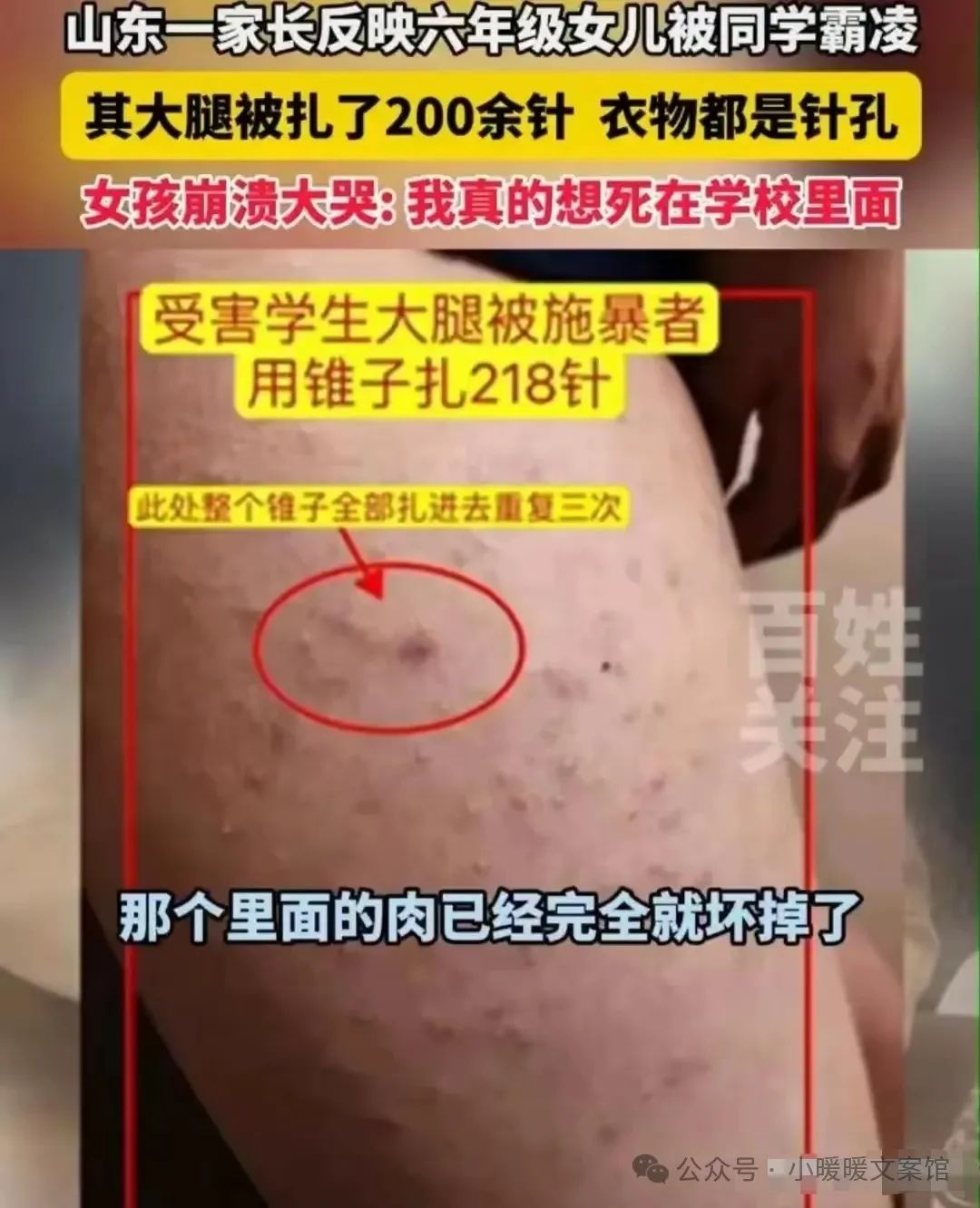 女生被扎218针为何未达校园霸凌标准