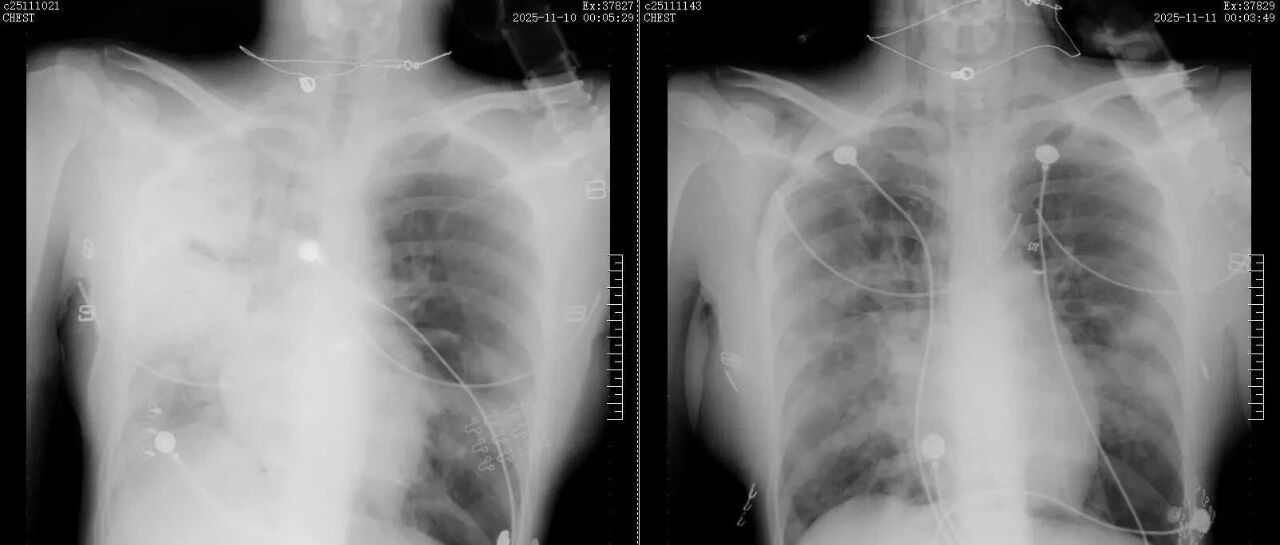 cover_image