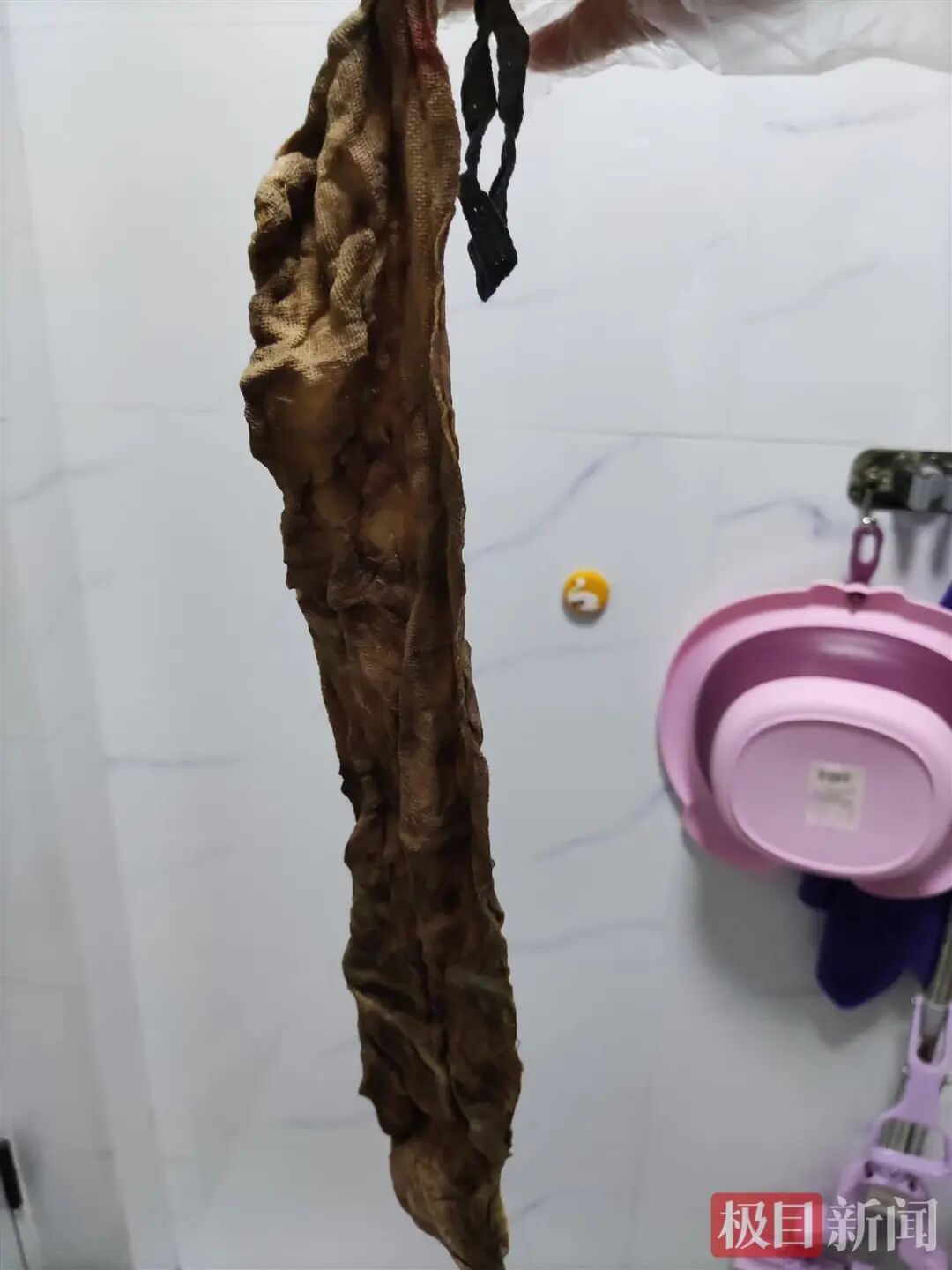 纱块怎么利用哈尔滨女子产后腹痛！竟拽出一块纱布！已发黑……_https://www.jmylbn.com_新闻资讯_第11张