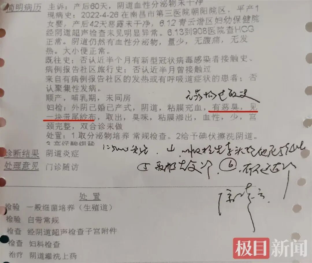 纱块怎么利用哈尔滨女子产后腹痛！竟拽出一块纱布！已发黑……_https://www.jmylbn.com_新闻资讯_第12张