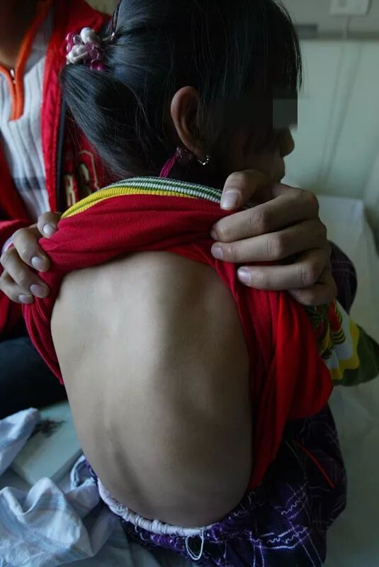 各位老铁进来看看,有没有得这个病的,怎么治