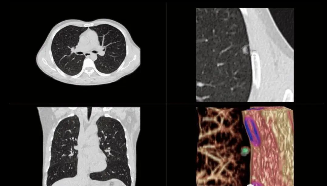 联影ct怎么样【医讯】勐腊县人民医院引进国产联影高端64排128层螺旋CT正式投入使用_https://www.jmylbn.com_新闻资讯_第10张