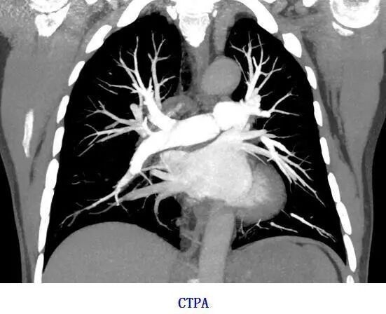 联影ct怎么样【医讯】勐腊县人民医院引进国产联影高端64排128层螺旋CT正式投入使用_https://www.jmylbn.com_新闻资讯_第5张