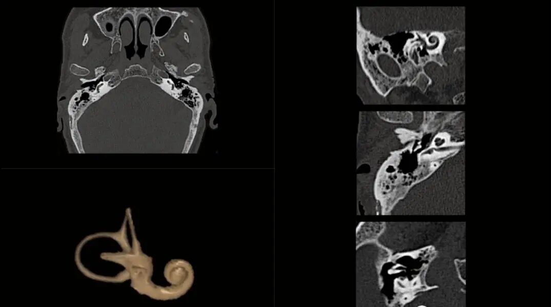 联影ct怎么样【医讯】勐腊县人民医院引进国产联影高端64排128层螺旋CT正式投入使用_https://www.jmylbn.com_新闻资讯_第12张