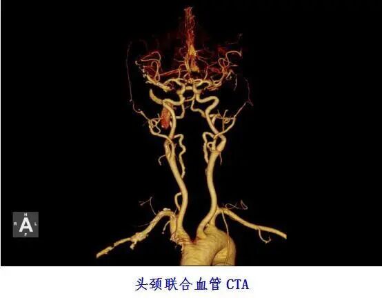 联影ct怎么样【医讯】勐腊县人民医院引进国产联影高端64排128层螺旋CT正式投入使用_https://www.jmylbn.com_新闻资讯_第6张