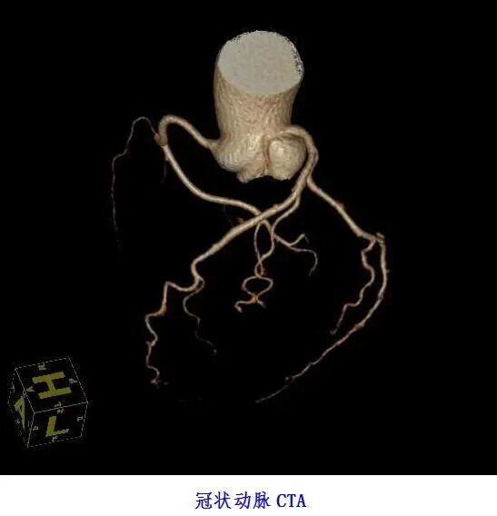 联影ct怎么样【医讯】勐腊县人民医院引进国产联影高端64排128层螺旋CT正式投入使用_https://www.jmylbn.com_新闻资讯_第7张