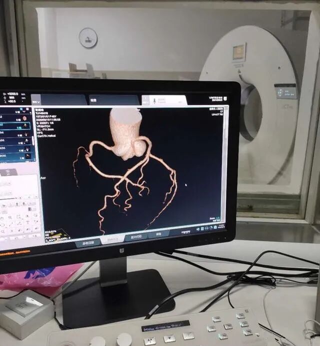 联影ct怎么样【医讯】勐腊县人民医院引进国产联影高端64排128层螺旋CT正式投入使用_https://www.jmylbn.com_新闻资讯_第4张