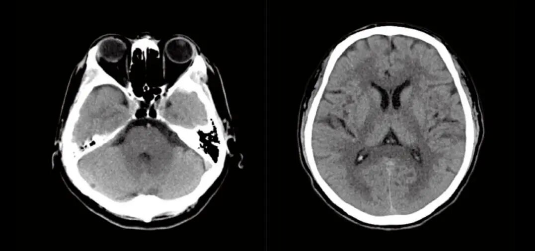 联影ct怎么样【医讯】勐腊县人民医院引进国产联影高端64排128层螺旋CT正式投入使用_https://www.jmylbn.com_新闻资讯_第11张