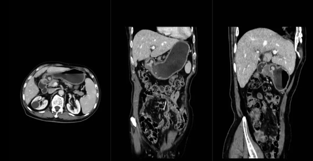 联影ct怎么样【医讯】勐腊县人民医院引进国产联影高端64排128层螺旋CT正式投入使用_https://www.jmylbn.com_新闻资讯_第9张