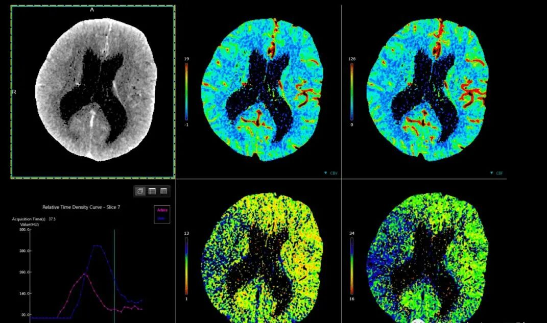 联影ct怎么样【医讯】勐腊县人民医院引进国产联影高端64排128层螺旋CT正式投入使用_https://www.jmylbn.com_新闻资讯_第8张