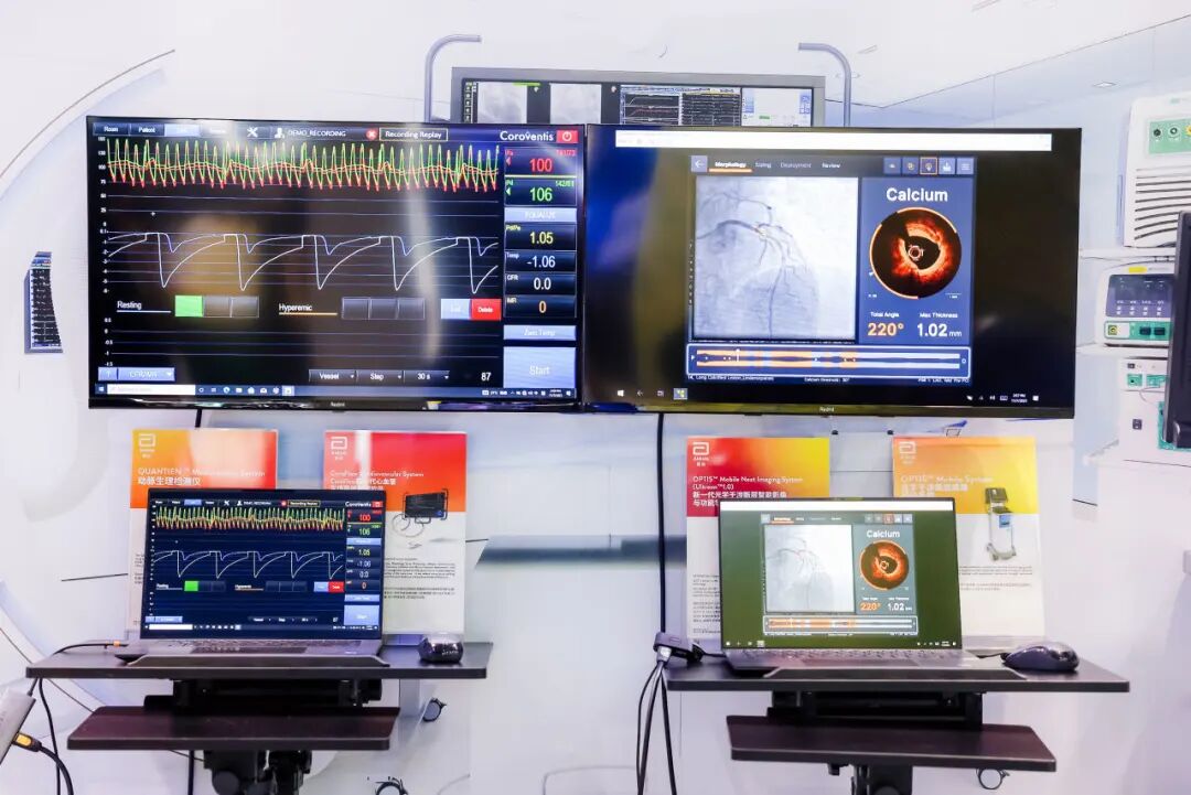 介入怎么进导管雅培新一代OCT成像导管首次亮相进博——赋能冠脉介入治疗，全面提高诊疗效率_https://www.jmylbn.com_新闻资讯_第3张