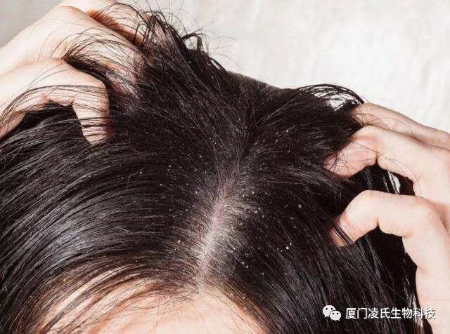 头螨的危害并不是看起来那么简单...........