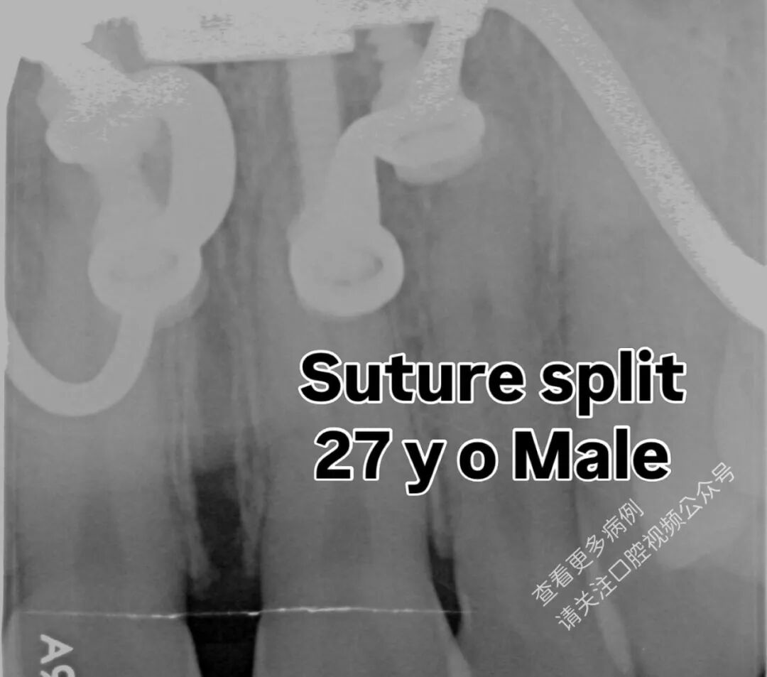 这样的正畸操作，你见过吗