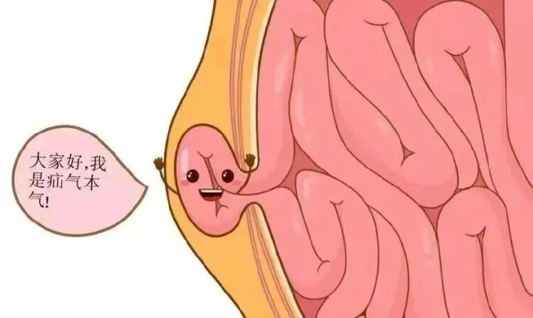 疝气补片怎么用【精业】勿以“疝”小而不为！带您了解第八医院“腹腔镜下腹壁切口疝补片修补术_https://www.jmylbn.com_新闻资讯_第5张