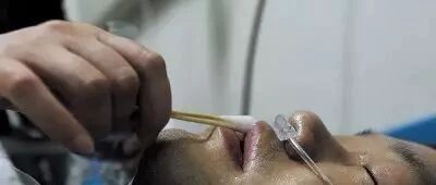 患者口渴用棉签蘸水过时啦！这几种方法方便还实用