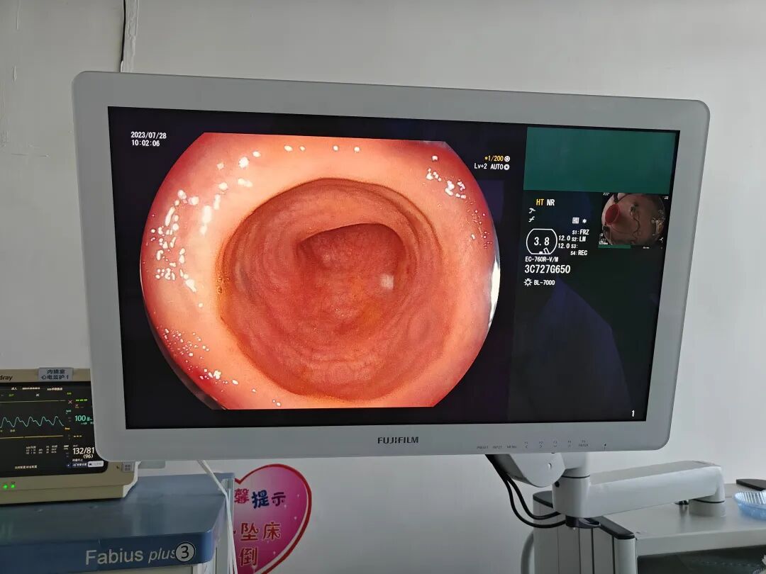 富士胃镜英文怎么写【新仪器新设备】“镜”观世界，健康“胃”来——富士VP-7000放大高清电子胃肠镜在我院投入使用_https://www.jmylbn.com_新闻资讯_第6张