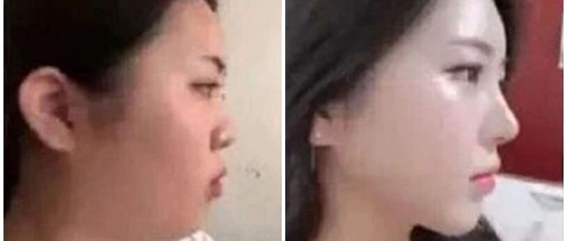 发条乐点：猜猜我老婆动了哪里？