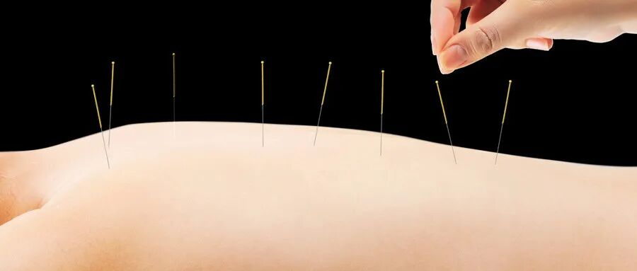 为什么输血不能用小针中医无急救？这误会可深了！四针下去，几近休克的病人奇迹恢复！_https://www.jmylbn.com_新闻资讯_第3张