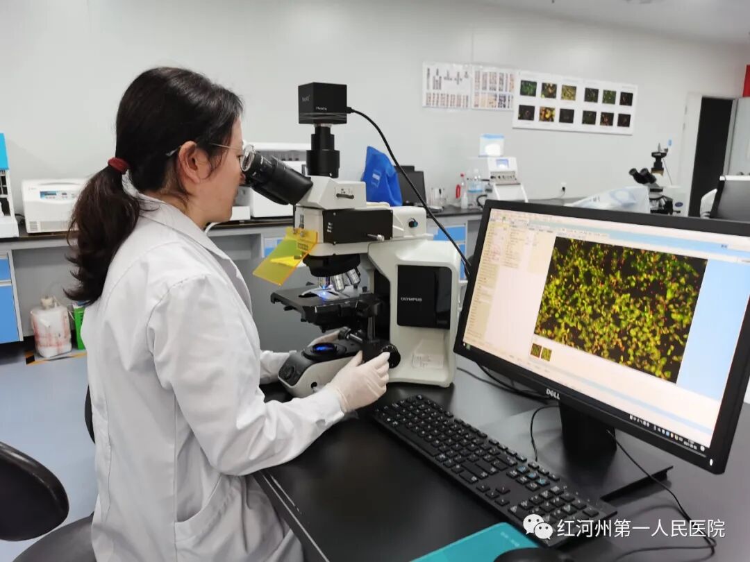 妇科荧光检查是什么生殖道分泌物细菌及真菌联合检测，为女性带来福音_https://www.jmylbn.com_新闻资讯_第11张