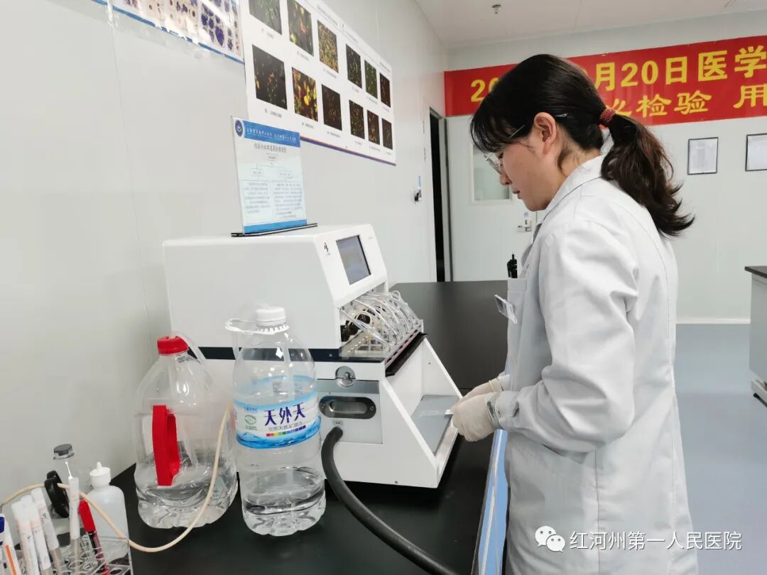 妇科荧光检查是什么生殖道分泌物细菌及真菌联合检测，为女性带来福音_https://www.jmylbn.com_新闻资讯_第12张