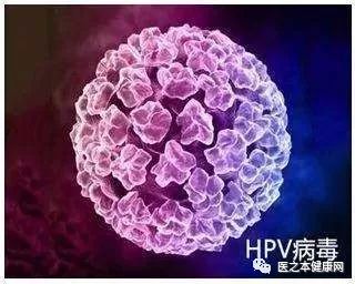 妻子感染了HPV，丈夫要不要也检查？（医之本健康网独家发表）