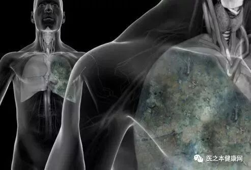 你见过谁得“心癌”吗？