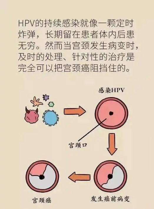 hpv病毒会终身携带吗？感染了hpv该怎么治疗？